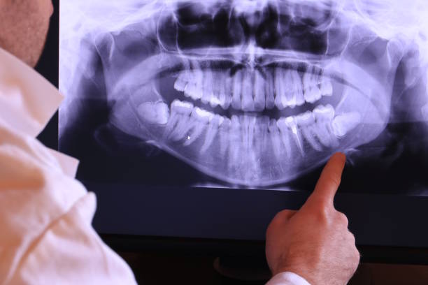 Best Emergency Dental Care for Trauma or Injury in Estherville, IA
